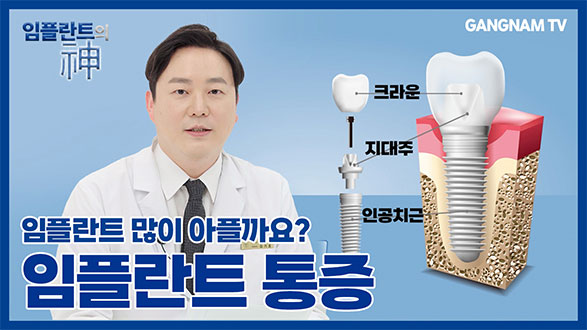 충북 제천에 위치한 서울강남플란트치과의 대표원장 김기홍원장이 임플란트수술 통증 관련하여 설명.